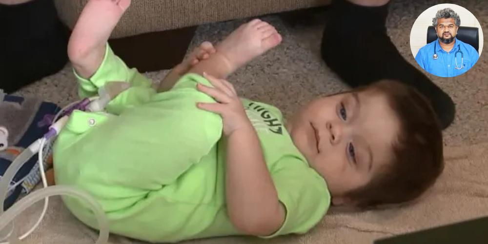 জন্মগতভাবে মলদ্বার না থাকা বা মলদ্বারে ত্রুটি - ডাঃ আব্দুল্লাহ-আল-মামুন